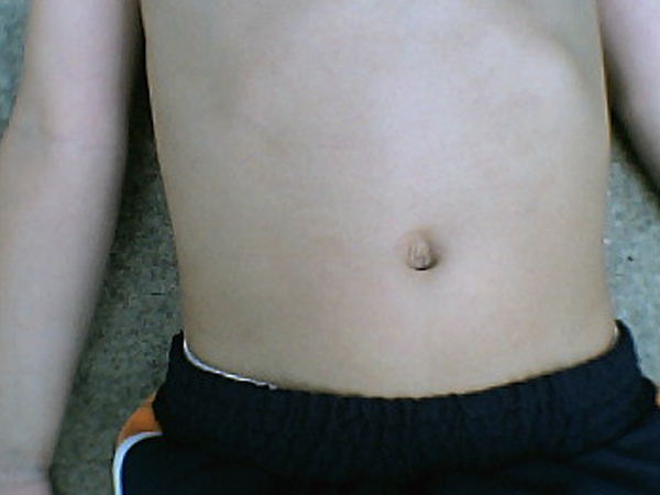 4. ಹೊಟ್ಟೆಯ ಭಾಗದಲ್ಲಿ ಕೂದಲಿರುವ ವ್ಯಕ್ತಿಗಳಲ್ಲಿ ಹೊಕ್ಕುಳ ಕೊಳೆ ಹೆಚ್ಚೇ ಇರುತ್ತದೆ 