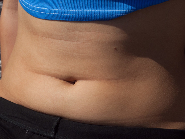 10. ಹೆಚ್ಚಿನವರ ಹೊಕ್ಕಳು ಒಳಮುಖ ಸೆಳೆದಿರುತ್ತವೆ 