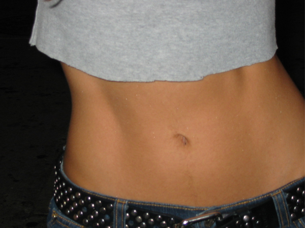 7. ಹೊಕ್ಕಳು ಪ್ರತಿಯೊಬ್ಬರಲ್ಲಿಯೂ ಇರಲೇಬೇಕೆಂದಿಲ್ಲ 