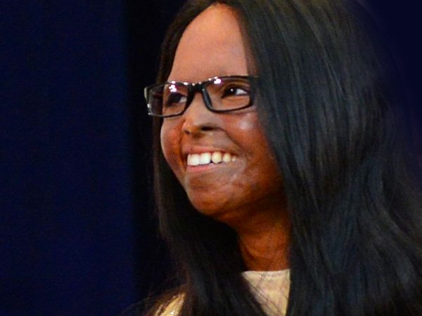 ಆ್ಯಸಿಡ್ ದಾಳಿ