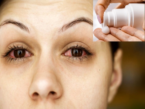 ಕಣ್ಣುಗಳಿಗೆ ತುರಿಕೆ