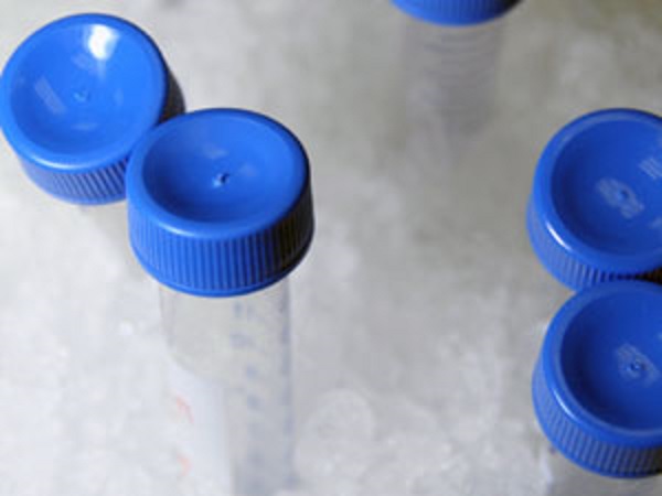 ಪುರುಷರು ತಮ್ಮ ವೀರ್ಯಾಣುಗಳನ್ನು ಕಾಪಾಡಿಕೊಳ್ಳಲು ಲಭ್ಯವಿರುವ ವಿಧಾನಗಳೆಂದರೆ: