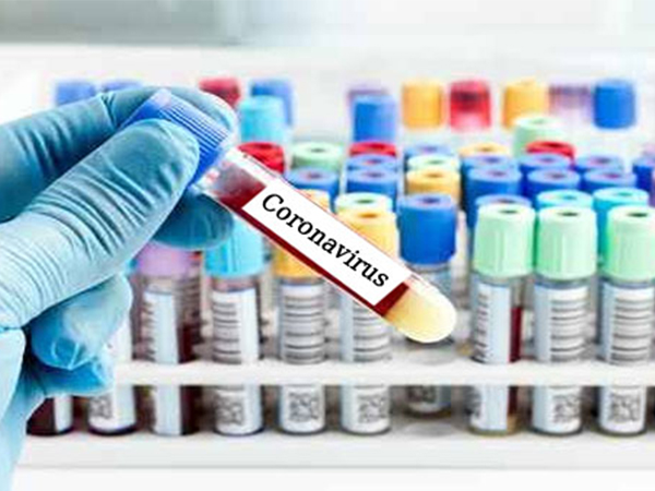 14, ಕೊರೊನಾ ವೈರಸ್‌ಗೆ ಯಾವ ಚಿಕಿತ್ಸೆ ಒಳ್ಳೆಯದು?