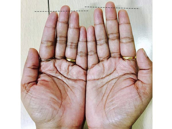 ಎ. ತೋರು ಬೆರಳುಗಿಂತ ಉಂಗುರ ಬೆರಳು ಉದ್ದವಾಗಿರುವುದು