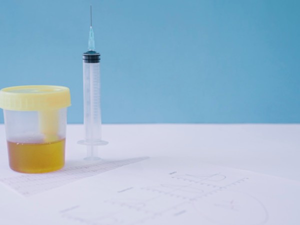 ಯುರೋಥೆರಪಿ