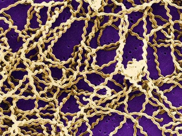 7. ಲೆಪ್ಟೋಸ್ಪಿರೋಸಿಸ್