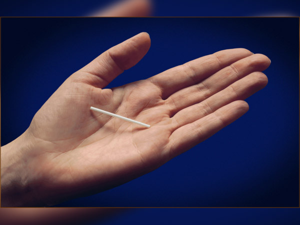 8. ಜನನ ನಿಯಂತ್ರಣ ಪ್ಯಾಚ್ : -