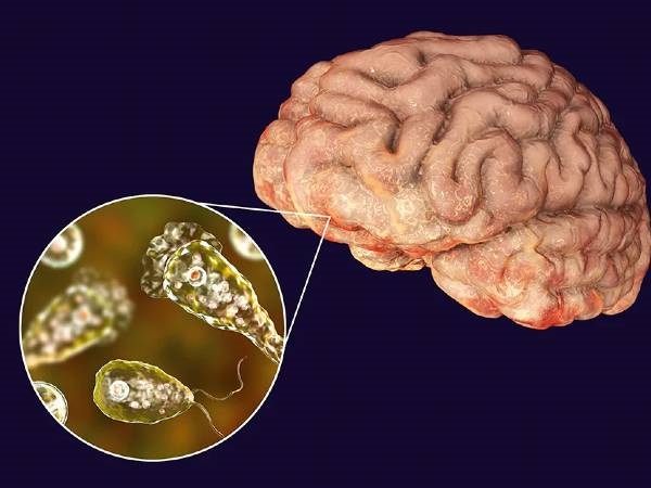 ಟೆಕ್ಸಾಸ್‌ನಲ್ಲಿ ಬಾಲಕನ ಬಲಿ ತೆಗೆದ ಅಮೀಬಾ