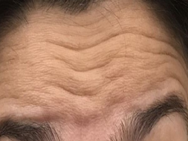 ಗುರು ರೇಖೆ: