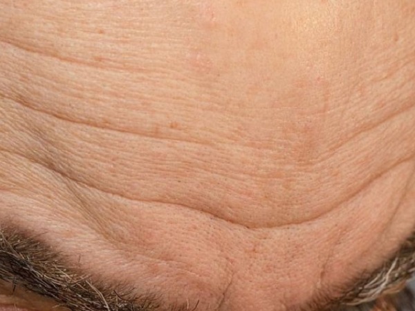 ಶುಕ್ರ ರೇಖೆ: 