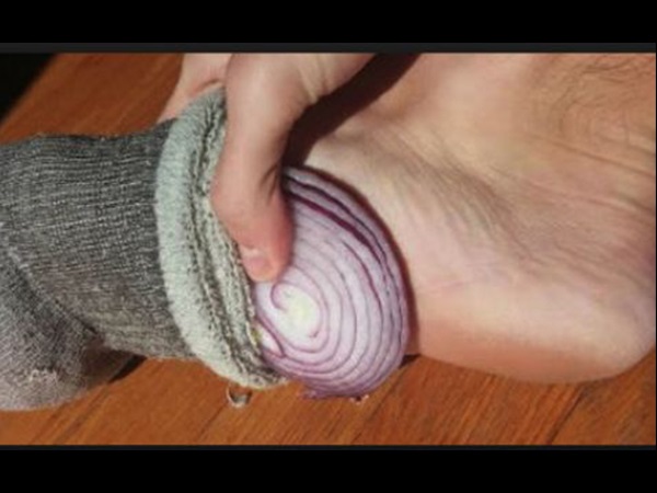 ಬ್ಯಾಕ್ಟಿರಿಯಾ, ಕೀಟಾಣು ನಾಶಪಡಿಸಿ ದುರ್ವಾಸನೆ ತಡೆಯುತ್ತೆ