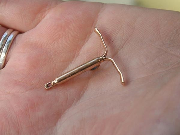 2. IUDs (ಕಾಪರ್ಟಿ) 2. IUDs (ಕಾಪರ್ಟಿ)