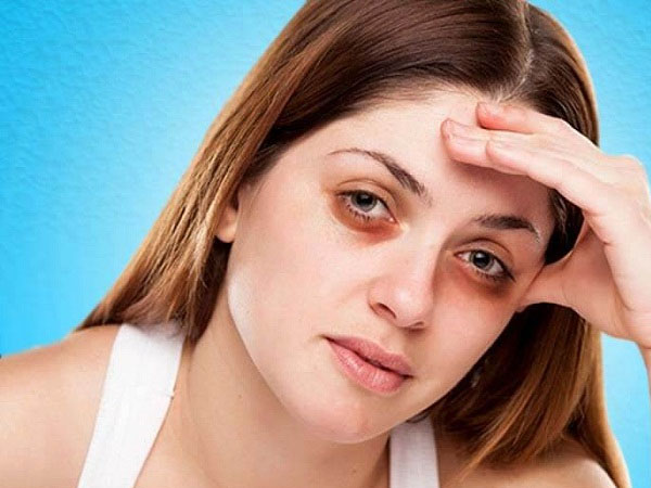 Homemade Remedies To Get Rid Of Dark Circles in Kannada