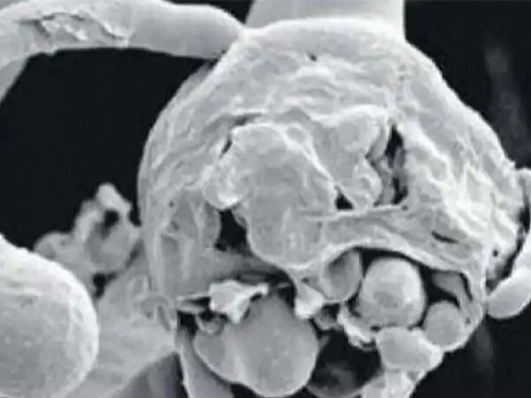 ಬ್ಲ್ಯಾಕ್‌ ಫಂಗಸ್‌ಗಿಂತ ಅಪಾಯಕಾರಿಯಾಗಿರುವ ವೈಟ್‌ ಫಂಗಸ್