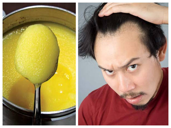 6. ಕೂದಲ ಬೆಳವಣಿಗೆಗೂ ತುಪ್ಪ ಬೇಕು