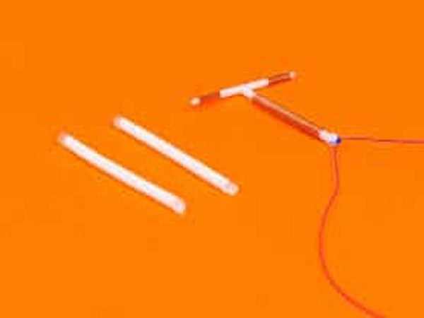 ಇಂಪ್ಲ್ಯಾಂಟ್ಸ್ ಹಾಗೂ IUD ಎರಡರ ನಡುವೆ ಇರುವ ಹೋಲಿಕೆ