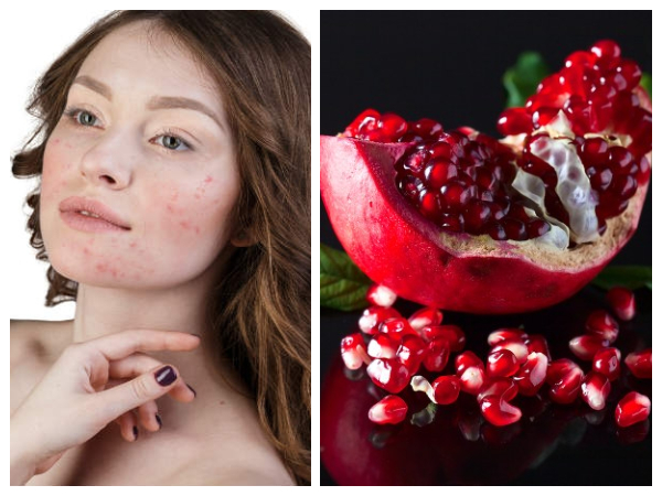 ತ್ವಚೆಗೆ ಹೊಳಪು: