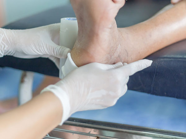 ಡಯಾಬಿಟಿಕ್ ಫೂಟ್ ಸಮಸ್ಯೆ ತಡೆಗಟ್ಟುವುದು ಹೇಗೆ?