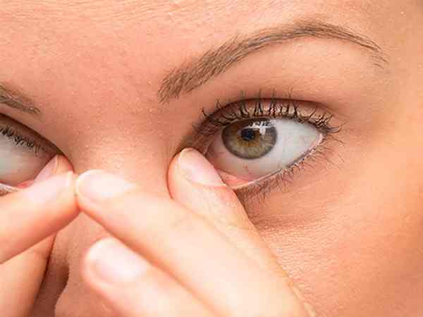 3. ಕಣ್ಣಿನ ಉರಿ