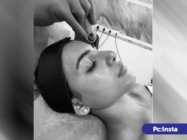 ವಿಟಮಿನ್‌ ಸಿ ಅವಶ್ಯಕ