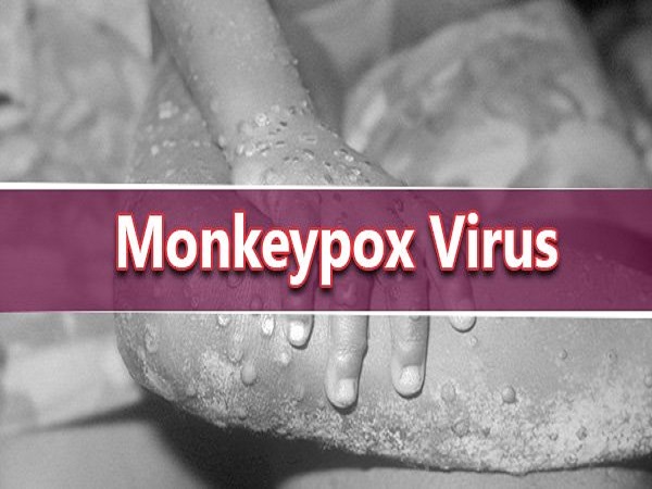 ಮಂಕಿಪಾಕ್ಸ್ ಎಂದರೇನು?