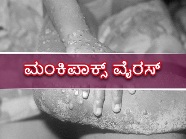 ಮಂಕಿಪಾಕ್ಸ್‌ ಲಕ್ಷಣಗಳೇನು?