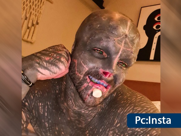 ನಾನೂ ನಾರ್ಮಲ್‌ ಮನುಷ್ಯ