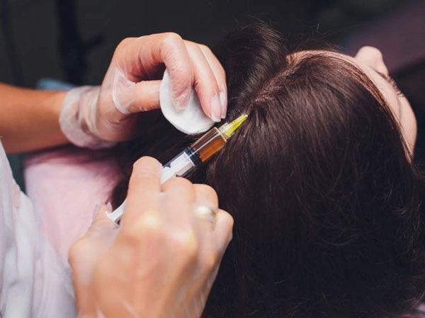 ಯಾವ ರೀತಿ ಕೂದಲನ್ನು ಫಿಕ್ಸ್ ಮಾಡುತ್ತಾರೆ!