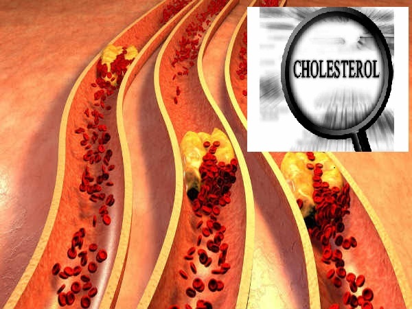 ಕೊಲೆಸ್ಟ್ರಾಲ್ ಎಂದರೇನು..?