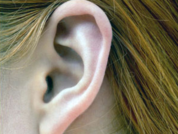 Ear Acne