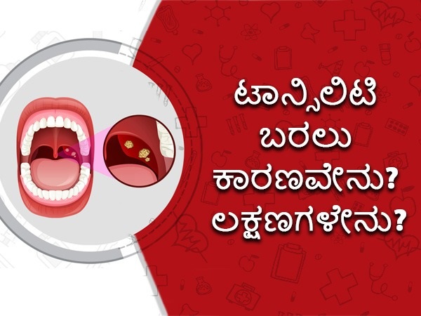 ಟಾನ್ಸಿಲಿಟಿಸ್ ಲಕ್ಷಣಗಳೇನು?