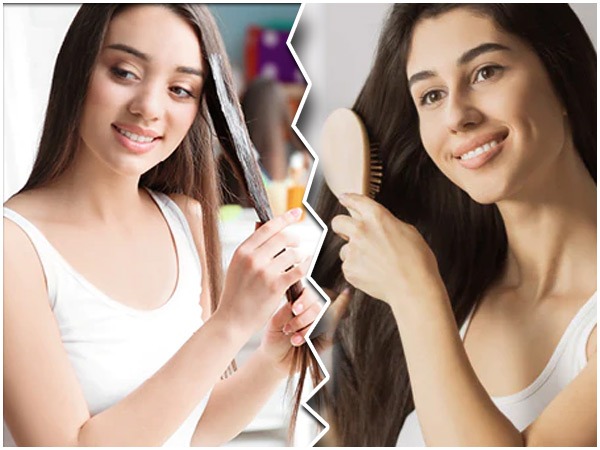 ಚಳಿಗಾಲದಲ್ಲಿ ತಲೆಹೊಟ್ಟು ತಡೆಗಟ್ಟಲು ಟಿಪ್ಸ್