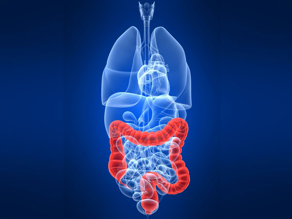 Colon Cancer, Colon Cancer,