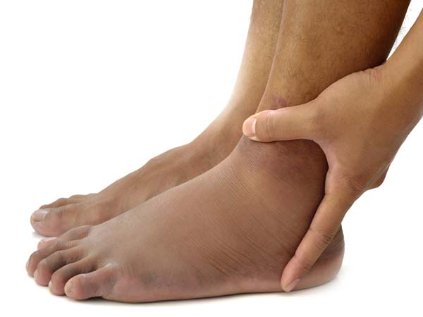 Warning Signs Your Feet Can Tell About Your Health