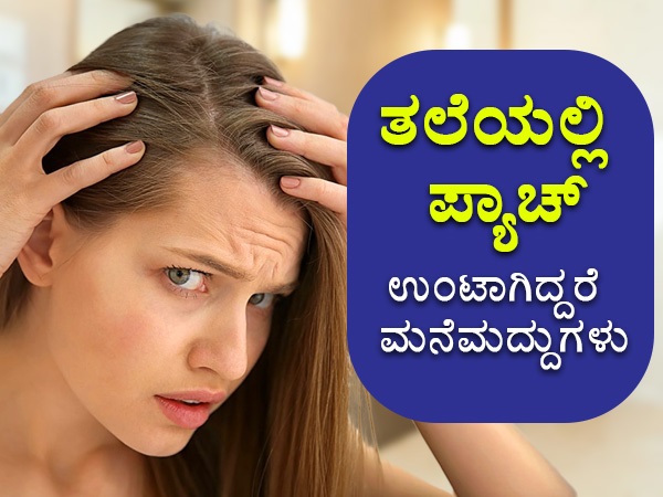 ಕೂದಲಿನಲ್ಲಿ ಪ್ಯಾಚಸ್‌ ಬರಲು ಕಾರಣವೇನು?