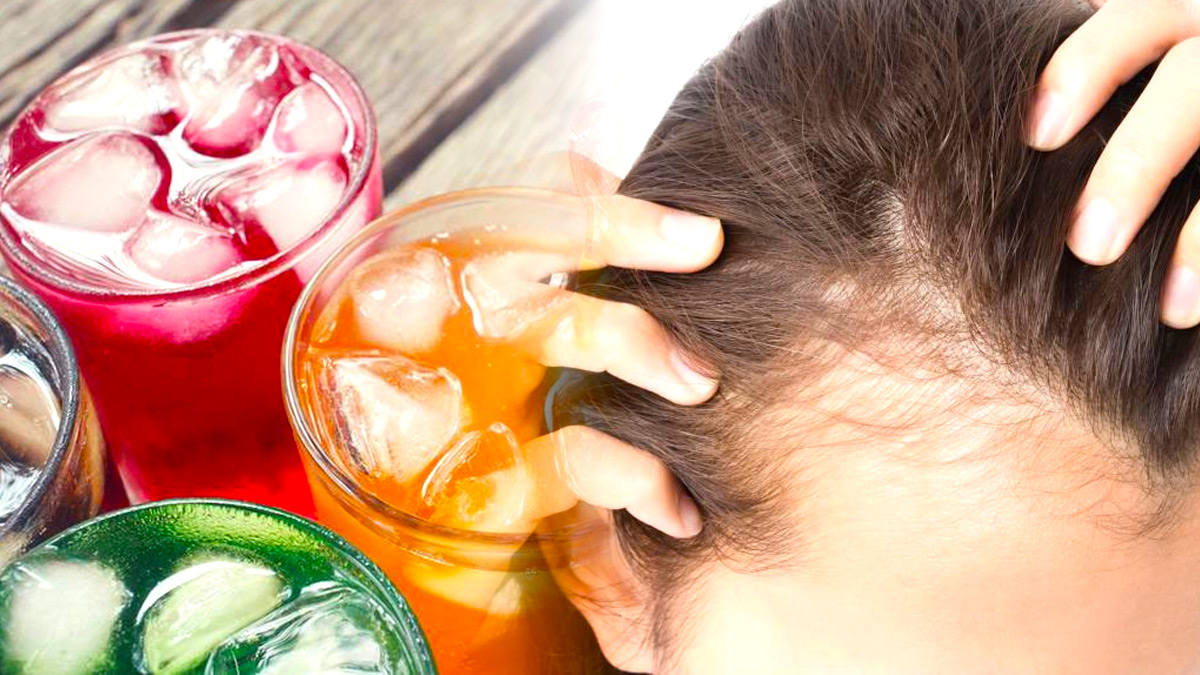 Bald Head Problem In men Bald Head Problem In men