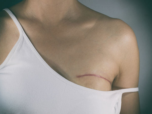 6. ಸ್ತನ ಕ್ಯಾನ್ಸರ್‌ ತಡೆಗಟ್ಟುತ್ತದೆ