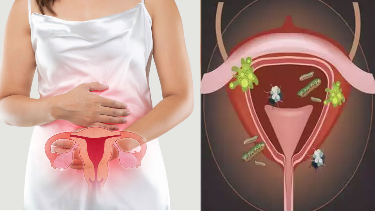 Menstrual Hygiene ಮುಟ್ಟಿನ ಸಮಯದಲ್ಲಿ ನೈರ್ಮಲ್ಯ ಕಾಪಾಡದಿದ್ದರೆ ಏನೆಲ್ಲಾ