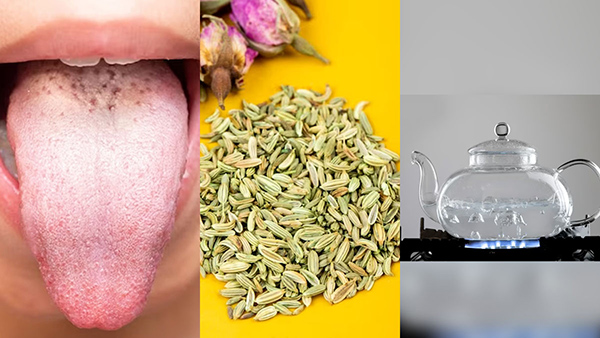 How To Get Rid Of White Tongue. Ayurvedic Tips For White Coating On Tongue in Kannada.
