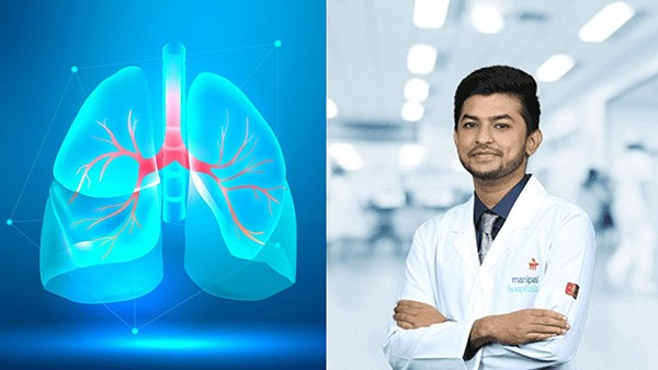 What Is The Relationship Between Viral Infections And Lung Cancer In Non-Smokers