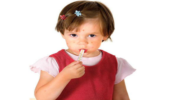 Measles symptoms treatment in Kannada