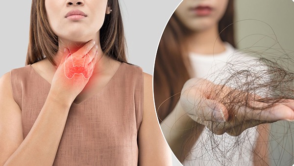 How To Reduce Thyroid Hair Fall