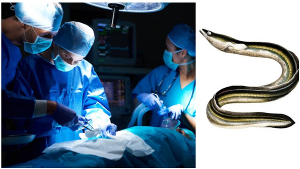 Doctors Removed 12-Inch Live Eel