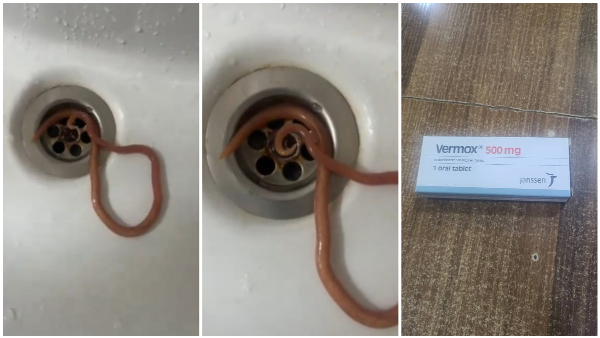 A Man Vomited A live worm After Taking Medicine For Stomach Ache