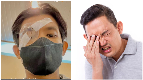 Man s Habit Of Eye Rubbing Leads Damages Cornea Man s Habit Of Eye Rubbing Leads Damages Cornea