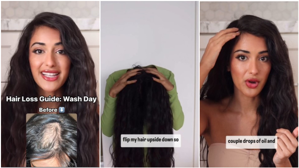 Woman Who Grows Her Hair Back From Ayurvedic Scalp Massage