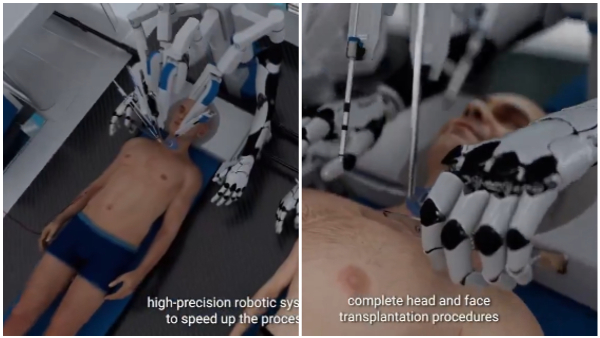 This Is World s First Head Transplant System Shocks Internet This Is World s First Head Transplant System Shocks Internet