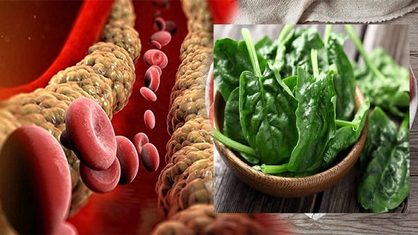 High Cholesterol Problem