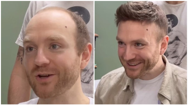 Bald Man s Incredible Hair Makeover Video Gone Viral