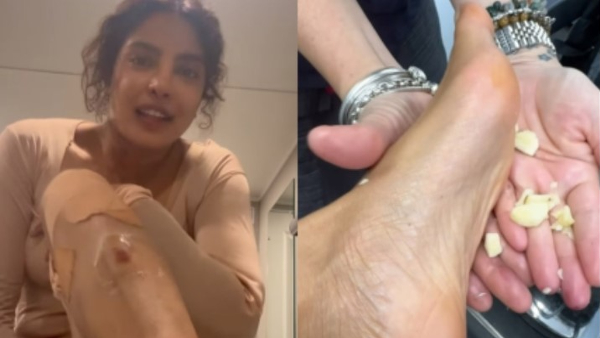 Priyanka Chopra Rubbed Garlic Cloves On Her Legs